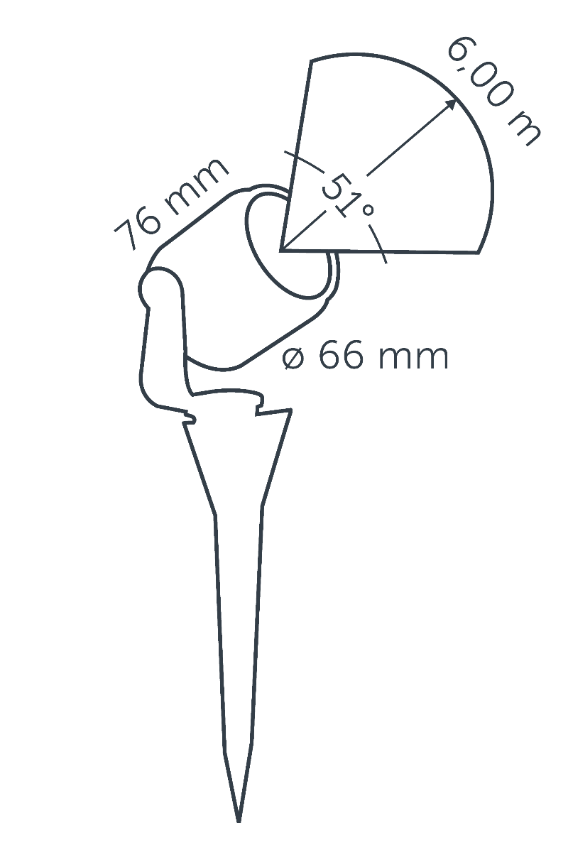 BIG SCOPE